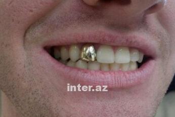 Asdqutmjog8kq13t5ekwagxtlwjaus48w7mpltmd.jpg
